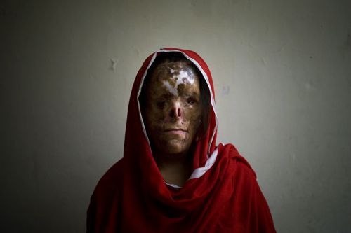 Pakistan Domestic Violence Pakistan Domestic Violence