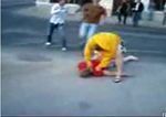Le rompe la cara en una pelea